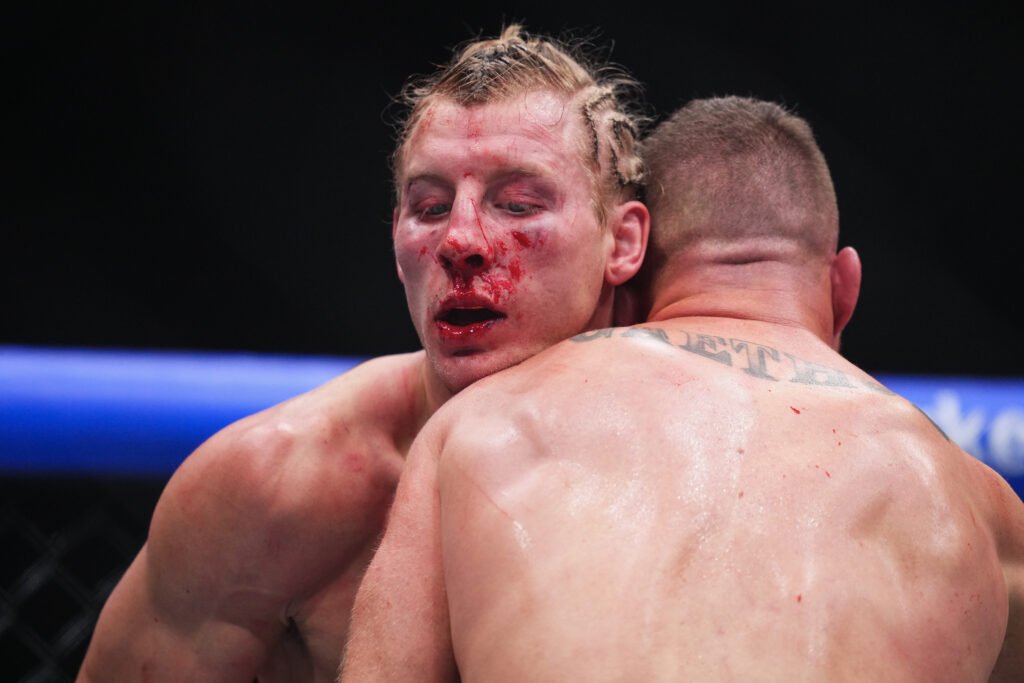 UFC’s Paddy Pimblett advised to ‘take a break for five, six years’ after brain damaging loss to Justin Gaethje