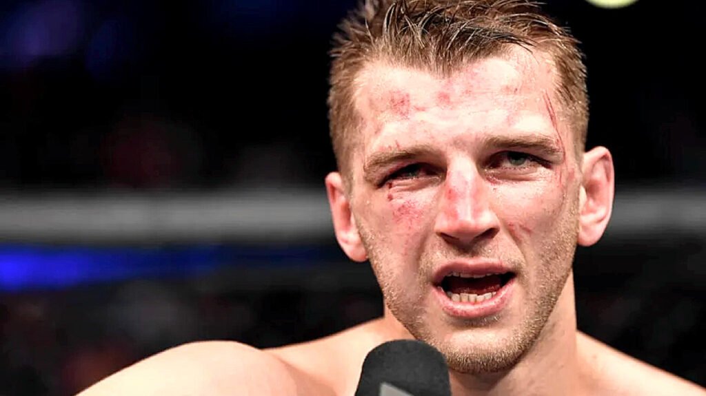 Dan Hooker responds to allegations amid family feud Dan Hooker responds to allegations amid family feud