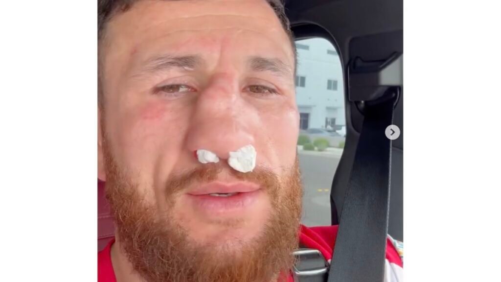 Merab Dvalishvili shatters nose in training Merab Dvalishvili shatters nose in training