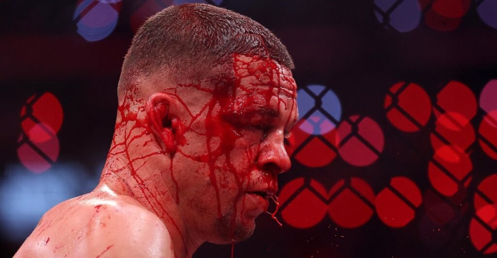 Nate Diaz releases first statement after losing to Mike Perry on Rousey vs. Carano card: ‘Time to kill now’ Nate Diaz releases first statement after losing to Mike Perry on Rousey vs. Carano card: ‘Time to kill now’