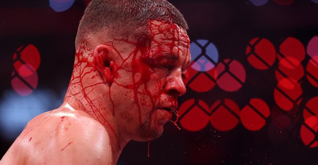 Stitch Duran on Nate Diaz corner stoppage against Mike Perry: ‘He ended up with 15 staples’ Stitch Duran on Nate Diaz corner stoppage against Mike Perry: ‘He ended up with 15 staples’