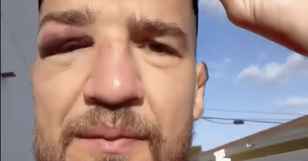 Yaroslav Amosov reveals injury suffered two weeks before UFC 328 win over Joel Alvarez Yaroslav Amosov reveals injury suffered two weeks before UFC 328 win over Joel Alvarez