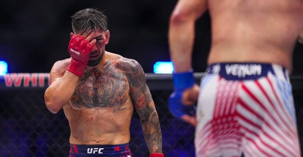 Report: Ilia Topuria injuries revealed following UFC White House loss
