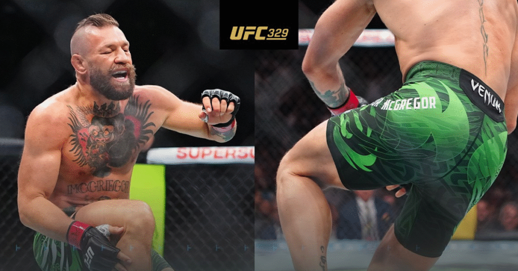 What Injury Did Conor McGregor Suffer At UFC 329? Conor McGregor